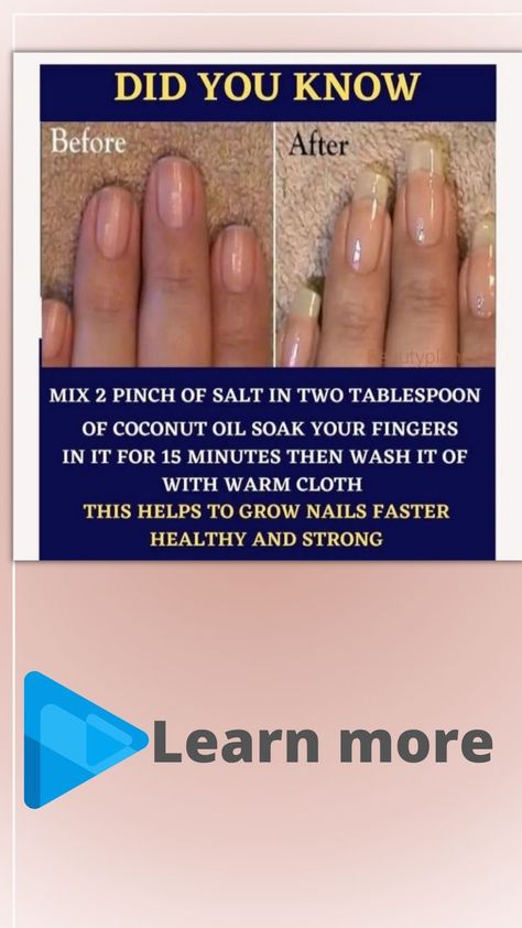 Grow Nails Faster, How To Grow Nails, Nail Polish Designs, Pinch Of Salt, Love Hair, Pretty Makeup, Nails On Fleek, How To Grow, Swag Nails