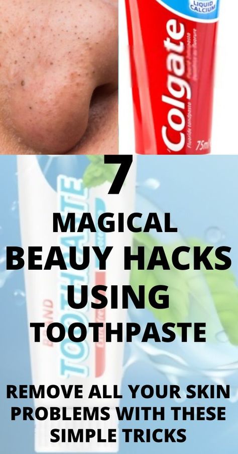 Beauty hacks,hacks for toothpaste,colgate toothpaste hacks,skin whitening ,Dark neck ,remove Dark spots,dark knees and elbows,Cleansing with toothpaste,nails cleansing ,nails whitening tips,how to get rid of pimples with toothpaste,how to get rid of pimples overnight toothpaste,blackheads and whiteheads removal,blackheads and whiteheads removal diy,exfoliate lips,exfoliate lips with toothbrush,colgate toothpaste hacks Toothpaste Hacks, Dark Knees And Elbows, Whiteheads Removal, Uses For Toothpaste, Dark Knees, How To Remove Blackheads, Get Rid Of Pimples, Rid Of Pimples, Colgate Toothpaste