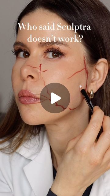 Dr Rebecka Gardell on Instagram: "Do you inject Sculptra with this pattern?" Sculptra Before And After Faces, Sculptra Before And After, Sculptra Injections, Botox Injections, Makeup, Pattern, On Instagram, Instagram, Make Up