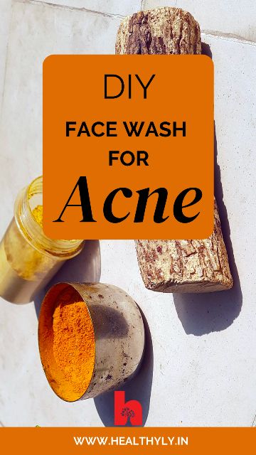 Comedonal Acne, Cystic Acne Remedies, Diy Face Wash, Acne Soap, Diy Acne, Acne Face Wash, Natural Acne Remedies, Acne Cream, Face Acne