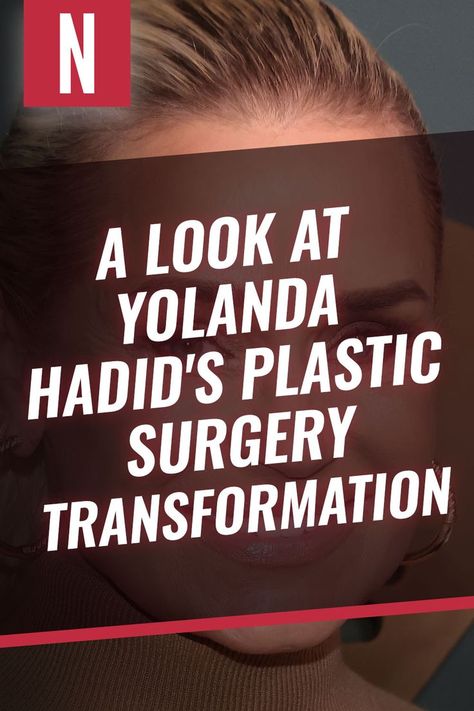 Anyone who has been following Yolanda Hadid would know that she has a love-hate relationship with plastic surgery. #plasticsurgery #yolandahadid #celebplasticsurgery Kyle Richards Plastic Surgery, Yolanda Hadid, Real Housewives Of Beverly Hills, Kyle Richards, Housewives Of Beverly Hills, Cosmetic Surgery, Real Housewives, Plastic Surgery, Beverly Hills