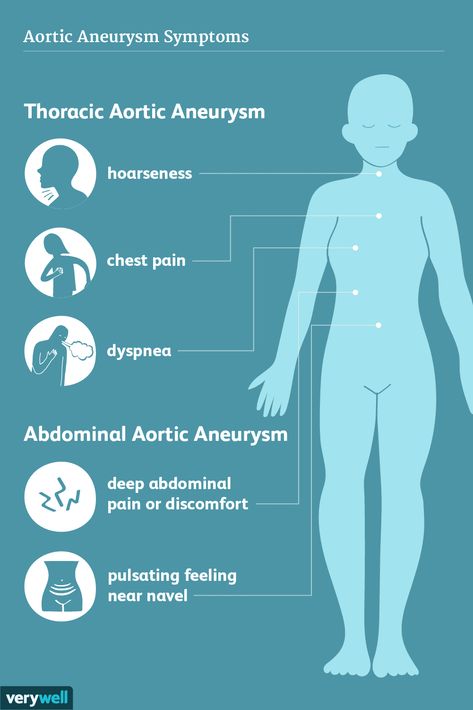 Aortic Aneurysm: Overview and More West Nile Virus Symptoms, Virus Symptoms, Lymph Glands, People With Hiv, West Nile Virus, Brain Surgeon, Medical Anatomy, Chest Pain, Muscle Aches