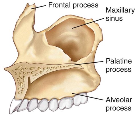 Maxilla Bone : Palatine Process; Alveolar Process Maxilla Anatomy, Human Body Diagram, Anatomy Stickers, Axial Skeleton, Maxillary Sinus, Dental Medicine, Maxillofacial Surgery, Skull Anatomy, Anatomy Bones