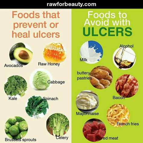 Foods that prevent ulcers and foods to avoid with ulcers Foods For Ulcers, Ulcer Diet, Atkins Diet Plan, Gerd Diet, Cabbage And Bacon, Stomach Ulcers, Kale And Spinach, Things To Eat, Healing Food