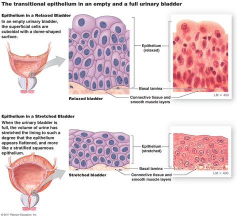 Transitional Epithelium, Urinary Bladder, Human Anatomy, Biology, Beauty Women, Anatomy, Science, Human, Beauty