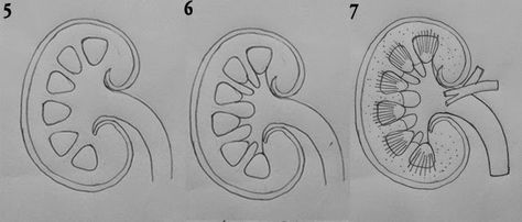 DRAW IT NEAT : How to draw LS of kidney How To Draw Kidney Step By Step, Kidney Drawing Easy, Kidney Diagram Drawing, Kidney Drawing, Kidney Diagram, Drawing Biology, Tutorials On Drawing, Easy Heart Drawings, Biology Drawing