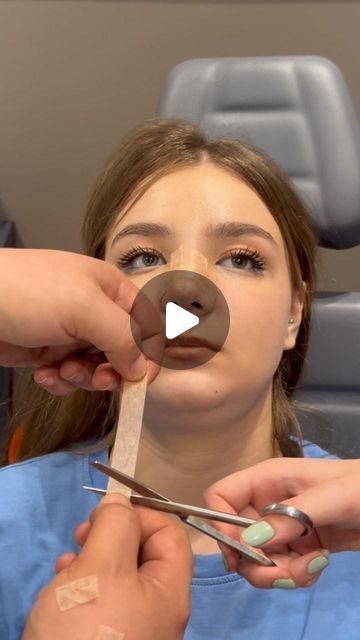 Nose Tape Before And After, Nose Taping, Non Surgical Nose Job, Nose Surgery Rhinoplasty, Ethnic Rhinoplasty, Crooked Nose, Rhinoplasty Nose Jobs, Rhinoplasty Before And After, Rhinoplasty Surgery