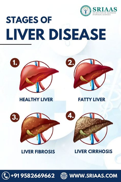 https://www.youtube.com/channel/UCmfxgAhb9rrc7mSMLAcv_uA Liver Fibrosis, Healthy Liver, The Liver, Whatsapp Number, Metro Station, Disease, Health Care