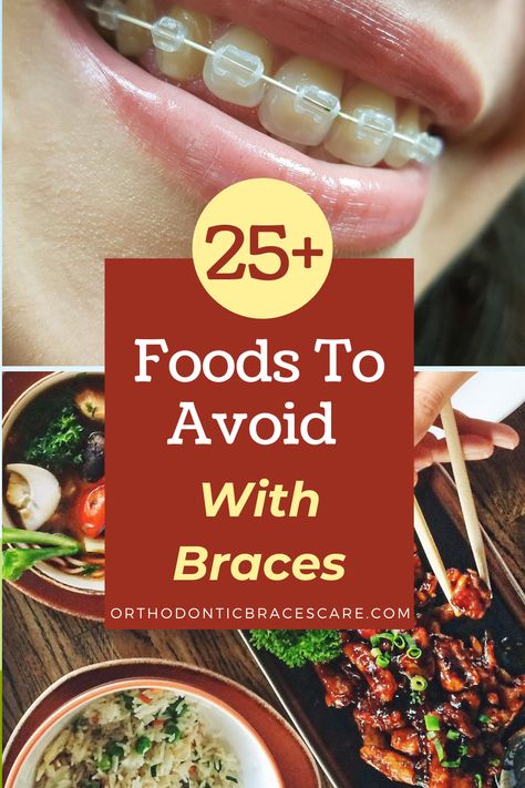 25+ Foods To Avoid While Wearing Braces: Get a huge list of foods to avoid with braces so that you can freely choose the perfect foods. Otherwise, it may damage braces and teeth. Braces Food To Avoid, Soft Food For Braces, Perfect Teeth Braces, Braces Care, Braces Food, Kids Braces, Hard Rolls, List Of Foods, Teeth Braces