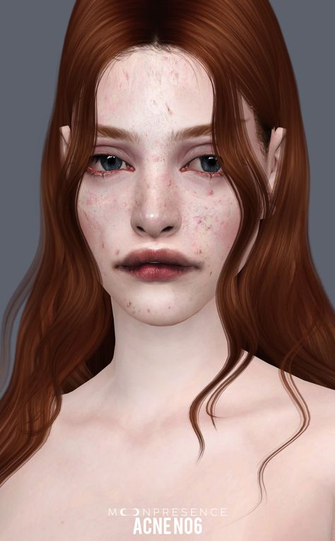 Eye Scar, Skin Marks, Nose Bleeds, Skin Details, Sims 4 Cc Skin, Sims Ideas, Cute Simple Wallpapers, Sims4 Cc, Sims 4 Cas