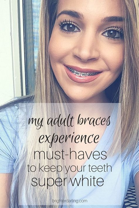 Women With Braces, Braces Food, Teeth Whitening Dentist, Skincare Steps, Adult Braces, Braces Tips, Getting Braces, Teeth Whitening Diy, Brace Face