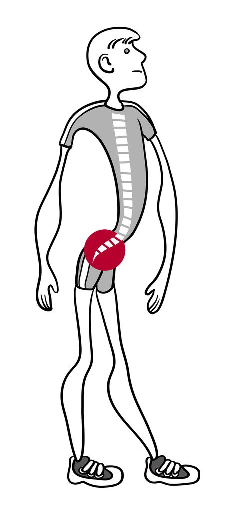 Hyperlordosis Lumbar Lordosis, Transversus Abdominis, Femur Bone, Wall Squat, Sway Back, Knock Knees, Muscle Structure, Hip Problems, Pelvic Tilt