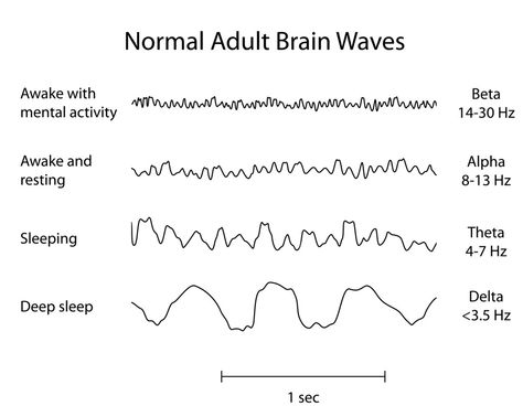 Sleep is wonderful – when you’re tired, nothing feels better!  But why do we need to sleep?  And why do we dream? Rpsgt Study, Sleep Physiology, Sleep Technologist, Memory Psychology, Uni Notes, Why Do We Dream, Physics Projects, Medical Notes, Basic Anatomy And Physiology