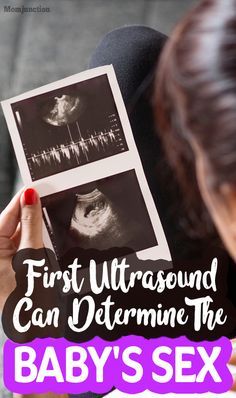 Baby Heart Rate Gender, 8 Weeks Pregnant Ultrasound, Ultrasound Boy Or Girl, Boy Ultrasound Pictures, Baby Gender Ultrasound, Ultrasound Gender Prediction, Boy Or Girl Prediction, Boy Ultrasound, Pregnancy Gender Prediction