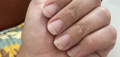 DIY Remedy for Split Nails Gel Strip Solutions - The DIY Handy Mom Split Nails Remedies, Nails Remedies, Nail Remedies, Split Nails, Nail Serum, Types Of Manicures, Damaged Nails, Diy Remedies, Nails Gel