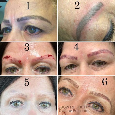 Bad Microblading, Surgical Gloves, Laser Removal, Microblading Eyebrows, Something Bad, Good To Know, Whats Good, Gone Wrong, Be Aware