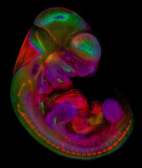 Confocal Microscopy, Nikon Small World, Microscopic Photography, Micro Photography, Rochester Institute Of Technology, Microscopic Images, Biology Art, Bio Art, Things Under A Microscope