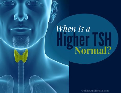 When is a higher TSH normal? // OnDietAndHealth.com High Tsh Levels, Hashimotos Disease, Vitamin K2, Health Advice, Gut Health, Blood Pressure, Health Tips, Fitness Motivation, Medical