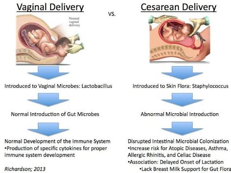 Women Are Preferring C-Section #Delivery Over Conventional Method. Child Delivery, Cesarean Delivery, Nursing 101, Child Nursing, Medical Mnemonics, Functional Nutrition, Baby Delivery, Health Literacy, Nursing Care Plan