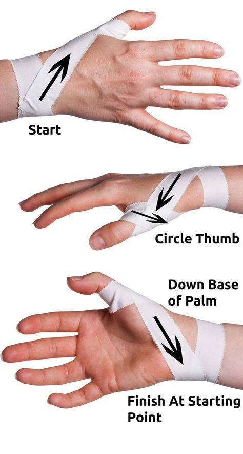 Thumb Spica Taping Step 2 | Physical Sports First Aid Athletic Training Sports Medicine, K Tape, Kt Tape, Kinesio Taping, Sports Therapy, Volleyball Workouts, Kinesiology Taping, Sprained Ankle, Hand Therapy