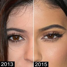 Kylie Jenner Plastic Surgery, Kylie Jenner Eyes, Kylie Jenner Body, Estilo Jenner, Kendall Jenner Makeup, Jenner Makeup, Robert Kardashian, Celebrity Plastic Surgery, Kylie Jenner Makeup