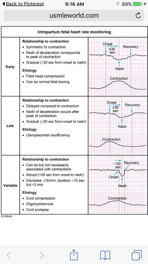 Fetal Heart Rate Monitoring Nursing, Fetal Heart Monitoring, Fetal Heart Rate, Nursing School Tips, Nurse Stuff, Nursing Education, School Tips, Nclex, Heart Rate