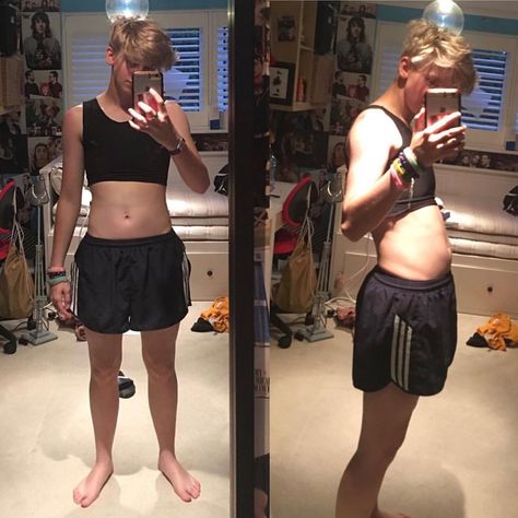 Found these old pics of me with a food baby 😍 I’ve named her Shakira. GONNA GO ON YOUNOW IN 30 MINUTES! Gonna do my T shot and give u guys updates on where I am regarding testosterone and top surgery so... if you’re interested, my YouNow is Noahfinnce Ftm Swimwear, Top Surgery Ftm, Noah Finnce, Miles Mckenna, Trans Masc, Top Surgery, Alex Kingston, Trans Boys, Old Pics