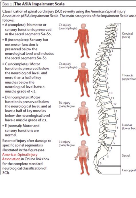ASIA impairment scale Nbcot Exam Prep, Nbcot Exam, Occupational Therapy Schools, Geriatric Occupational Therapy, Physical Therapy School, Physical Therapist Assistant, Physical Therapy Assistant, Occupational Therapy Assistant, Recreation Therapy