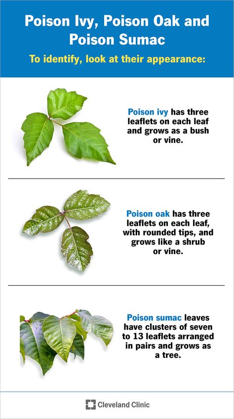 Poison Sumac Rash, Poison Sumac Plant, Poison Oak Rash, Identify Poison Ivy, Poison Ivy Leaves, Poison Sumac, Itchy Skin Rash, Poison Ivy Rash, Itchy Rash