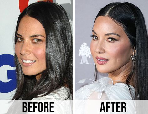 These Before And After Pics Of Olivia Munn Are INSANE—What Did She Do To Her Face? | SHEfinds Botox Brow Lift, Cheek Implants, Face Transformation, Chin Implant, Botox Before And After, Cheek Fillers, Before And After Pics, Celebrity Plastic Surgery, High Cheekbones