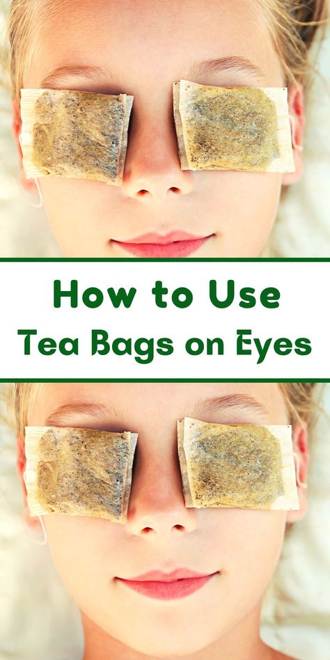 How to Use Tea Bags on Eyes - And Why it Works! Tea Bags For Eyes Aesthetic, Chamomile Tea Bags For Eyes, Chamomile Eye Compress, Tea Bags On Eyes, Tea Bags For Eyes, Swollen Eyelids Remedy, Tired Eyes Remedy, Teabags For Eyes, Eye Bag Remedies