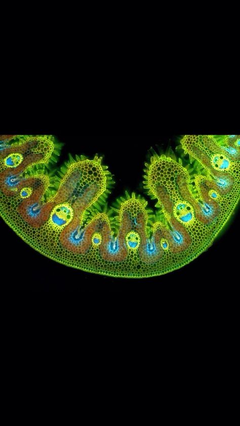 Grass under a microscope :D Grass Under Microscope, Germs Under A Microscope, Moss Under Microscope, Cells Under A Microscope, Bacteria Under Microscope, Cells Under Microscope, Microscopic Art, Science Pics, Microscopic Algae