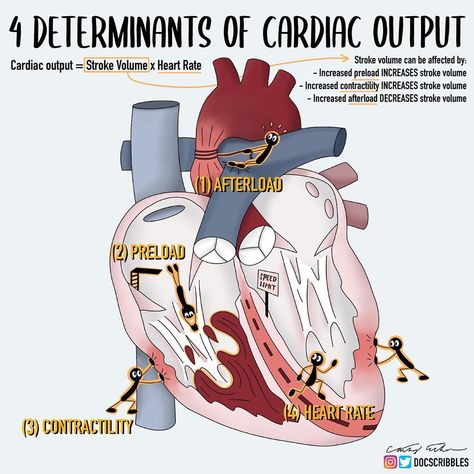 Cathy Cichon, MD, MPH on Instagram: “Cardiac output olympics 💪🏼❤️ . . . . . . #medicaleducation #meded #FOAMed #medicalillustration #cardiology #cardiacoutput #physiology” Cardiac Output, Basic Anatomy And Physiology, Medical Knowledge, Medical Illustration, Medical Education, Cardiology, Nurse Practitioner, Anatomy And Physiology, Heart Rate