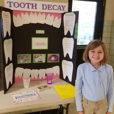 Tooth Decay Science Fair Project, 6th Grade Science Projects, Science Project Board, Presentation Ideas For School, Science Fair Projects Boards, Cool Science Fair Projects, Science Boards, Fourth Grade Science, Social Care