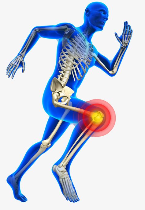 Knee Injury Recovery, Human Knee, Knee Bones, Knee Pictures, Jumpers Knee, Knee Ligaments, Runners Knee, Human Bones, Injury Recovery