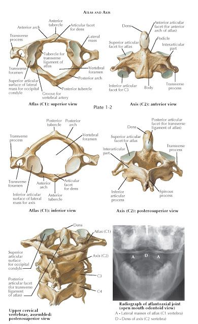 ANATOMY OF CRANIOCERVICAL JUNCTION BONY ANATOMY The craniocervical junction consists of the occiput and the first two cervical vertebrae... Anatomy Vertebrae, Head Muscles, Vertebral Artery, Intervertebral Disc, Cervical Vertebrae, Cruciate Ligament, Musculoskeletal System, Medical Anatomy, Major Muscles