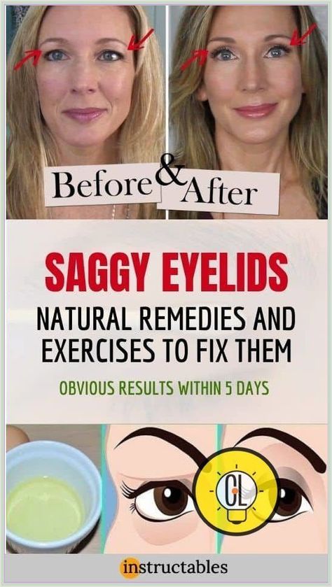 Natural Remedy for Sagging Eyelids-You Will See Results in 2 Minutes! Fix Droopy Eyelids, Sagging Eyelids, Droopy Eyelids, Eye Makeup Application, What Is Health, Healthy Life Hacks, Health Plus, Health Routine, Healthy Advice