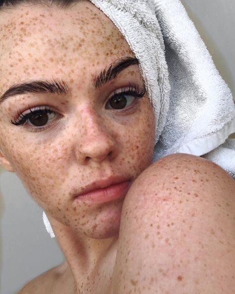 @broganquigley on Instagram: “Freckles 🧖🏽‍♀️” #summer #freckles #natural Freckles Summer, Freckles Natural, Summer Freckles, People With Freckles, Freckles Girl, Freckle Face, Feeling Insecure, My Vibe, Pretty People