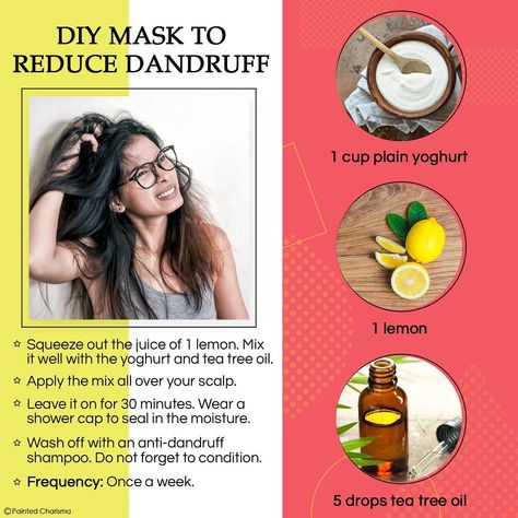 How To Reduce Dandruff, Get Rid Of Dandruff Fast, Aloe Vera For Sunburn, Hair Mask For Dandruff, Home Remedies For Dandruff, Reduce Dandruff, Home Remedies For Allergies, Rid Of Dandruff, Dandruff Hair