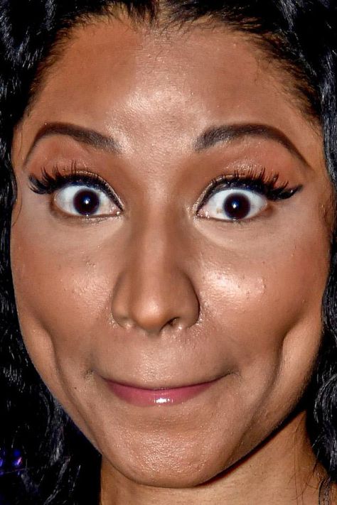 celebritycloseup:  nicki minaj  ewww zits around her nose and all over her face and chin Anti Makeup, Nicki Minaj 2017, Normal Face, Friends Actors, Nose Jobs, Bad Skin, Nikki Minaj, Shocked Face, Makeup Fails