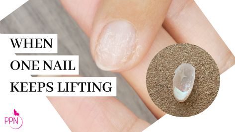 It’s acting up again—that index finger of mine. It is not uncommon to have a nail that perpetually lifts on you or your client. If this is happening to one of your clients or a few of them… there’s actually a big chance that it is not you; it’s them. However, after a while, the … How To Fix A Nail That Keeps Lifting | Step By Step Gel Nail Fix Read More » The post How To Fix A Nail That Keeps Lifting | Step By Step Gel Nail Fix appeared first on Paola Ponce Nails. Acrylic Nails At Home, Soft Gel Nails, Gel Nail Extensions, Damaged Nails, Nail Care Tips, Gel Extensions, Nail Strengthener, Index Finger, Soft Gel