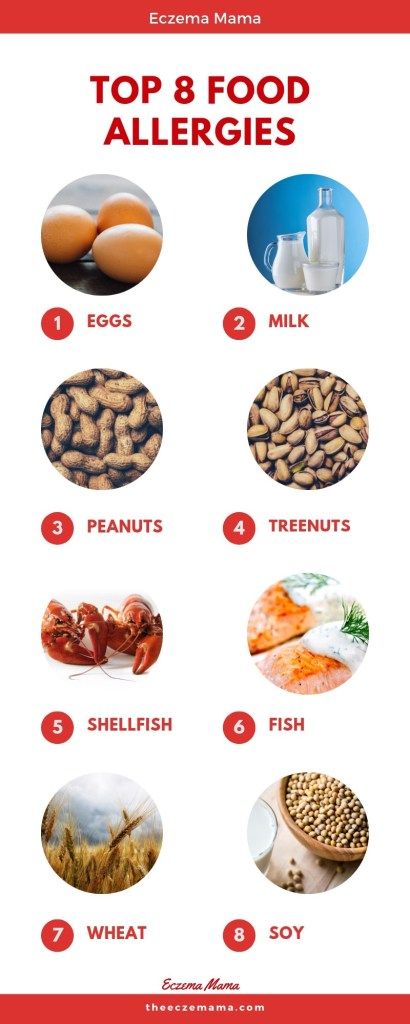 What are Food Allergies? Symptoms and Causes - Eczema Mama Food Allergies Symptoms, Food Intolerance Symptoms, Baby Food Allergies, Food Allergy Symptoms, Shellfish Allergy, Common Food Allergies, Food Allergies Awareness, Kids Allergies, Allergy Awareness