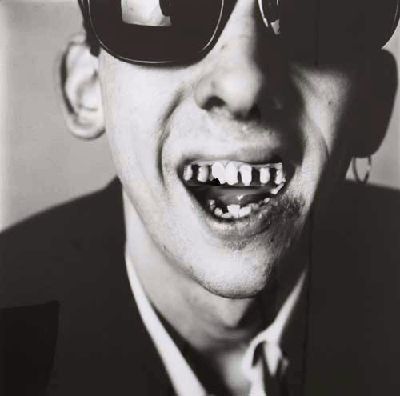 Shane Mcgowan, Shane Macgowan, Tooth Whitening, The Pogues, Band Photos, Music History, Music Icon, Dental Implants, Famous Faces