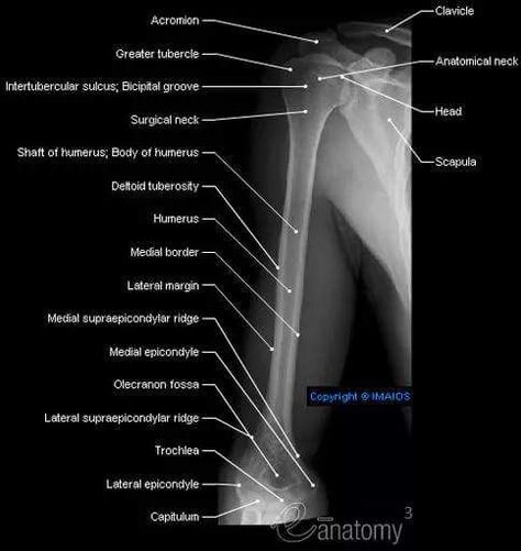 Medial Epicondyle, Radiography Student, Radiology Schools, Medical Radiography, Radiologic Technology, Radiology Student, Radiology Technician, Radiology Imaging, Anatomy Bones