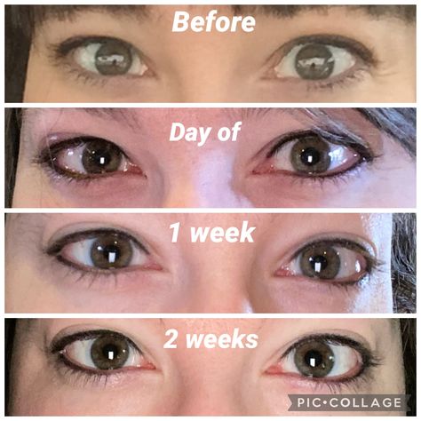 Permanent Top Eyeliner, Tattooed Eyeliner Before And After, Waterline Tattoo, Eyeliner Tattoo Permanent, Combo Brows, Top Eyeliner, Cosmetic Tattooing, Permanent Makeup Eyeliner, Permanente Make-up