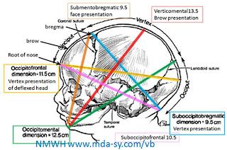 STUDY WITH FUN: diameters of fetal skull Nclex Practice Questions, Midwifery Student, Mcat Study, Skull Anatomy, Nursing Mnemonics, Biology Facts, Nursing School Survival, Human Anatomy And Physiology, Obstetrics And Gynaecology