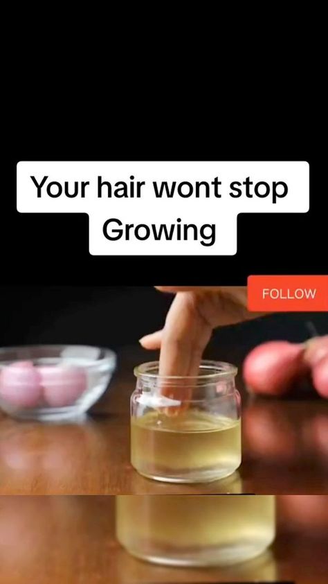 How To Grow Hair Fast, How To Grow Thicker Hair, Best Shampoo For Hair Growth, Grow Hair Naturally, Homemade Hair Growth, Best Shampoo For Hair, Homemade Hair Growth Oil, Make Hair Longer, Grow Black Hair