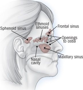 Paranasal Sinuses via Harvard Women's Health Watch Acute Sinusitis, Sinus Drainage, Blocked Sinuses, Paranasal Sinuses, Maxillary Sinus, Sinus Congestion Relief, Congestion Relief, Nasal Cavity, Sinus Pressure