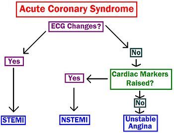 Acute coronary syndrome - MedRevise Acute Coronary Syndrome Nursing, Stemi Vs Nstemi, Endocrine Pharmacology, Nursing Math, Er Nursing, Medicine School, Acute Coronary Syndrome, Pharmacy Student, Cardiac Nursing