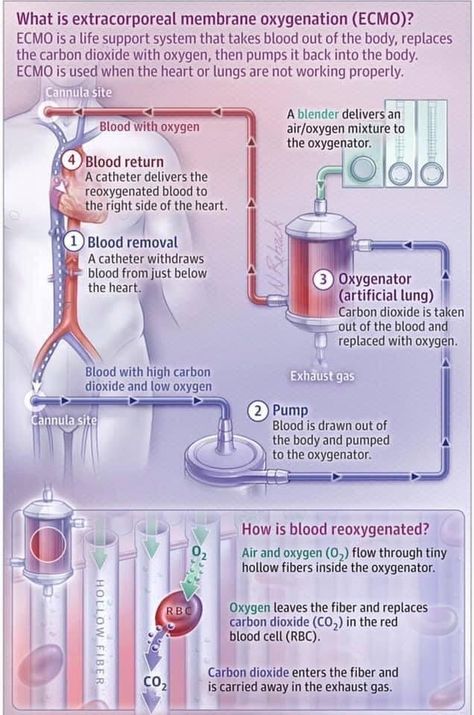 Extracorporeal Membrane Oxygenation, Cath Lab Nursing, Medical Terminology Study, Picu Nurse, Nursing Mnemonics, Family Nurse Practitioner, Nursing Student Tips, Pulmonology, Cardiac Nursing